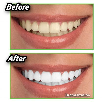 Miracle teeth - Izbeljivač zuba