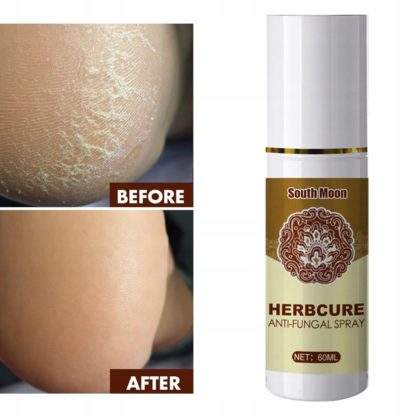 Herbcure - Sprej protiv gljivica i sličnih bolesti stopala