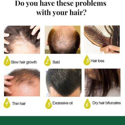 Sedmodnevni tretman za brži rast kose od đumbira - Ginger Hair Growth Sprayer